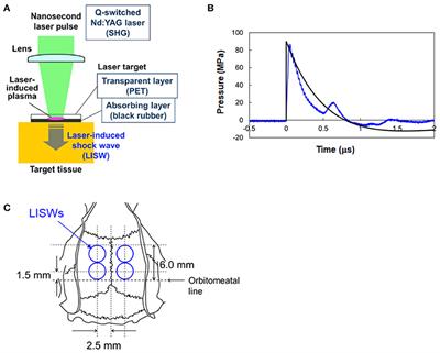 Behavioral and Histopathological Impairments Caused by Topical Exposure of the Rat Brain to Mild-Impulse Laser-Induced Shock Waves: Impulse Dependency